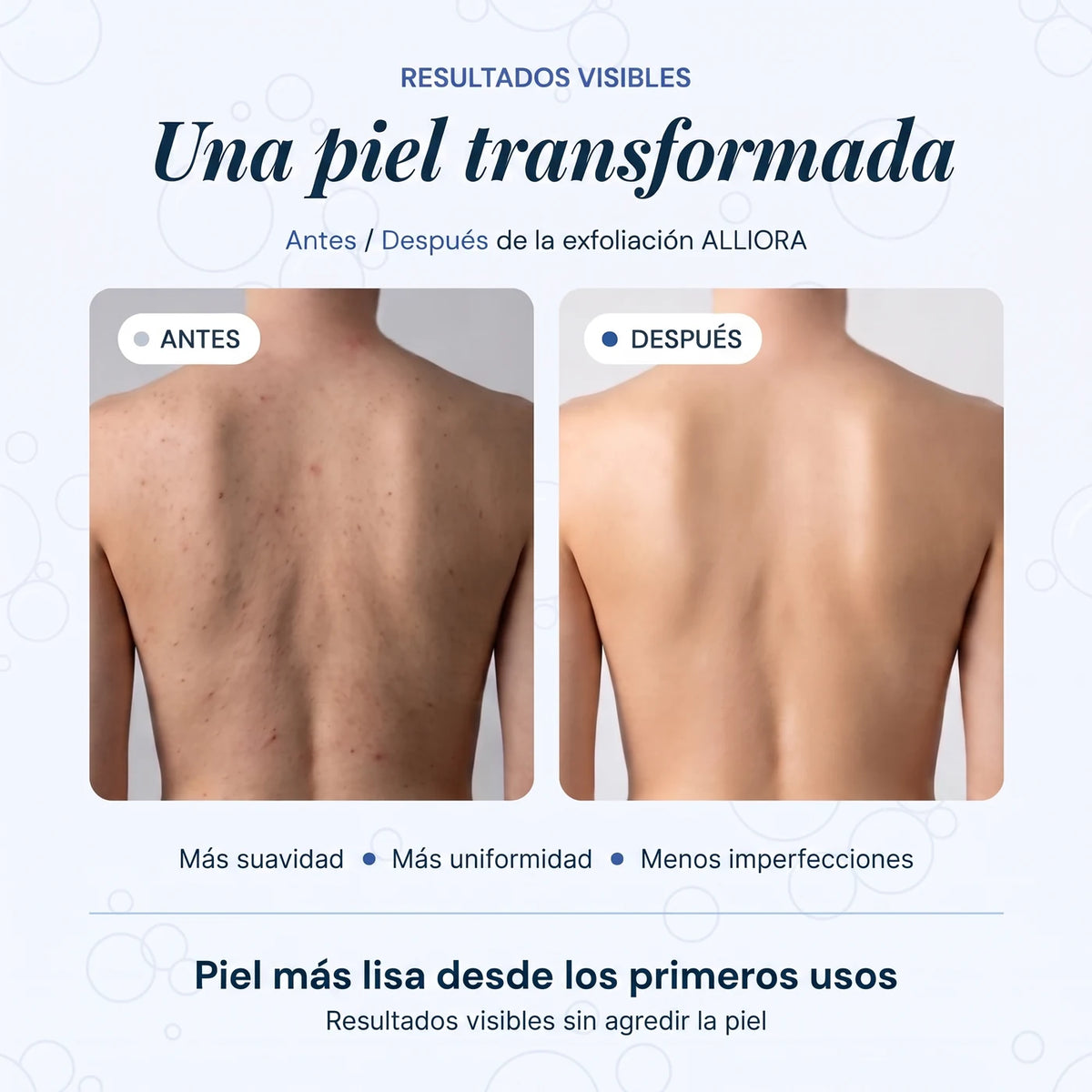Toalla de ducha exfoliante Alliora