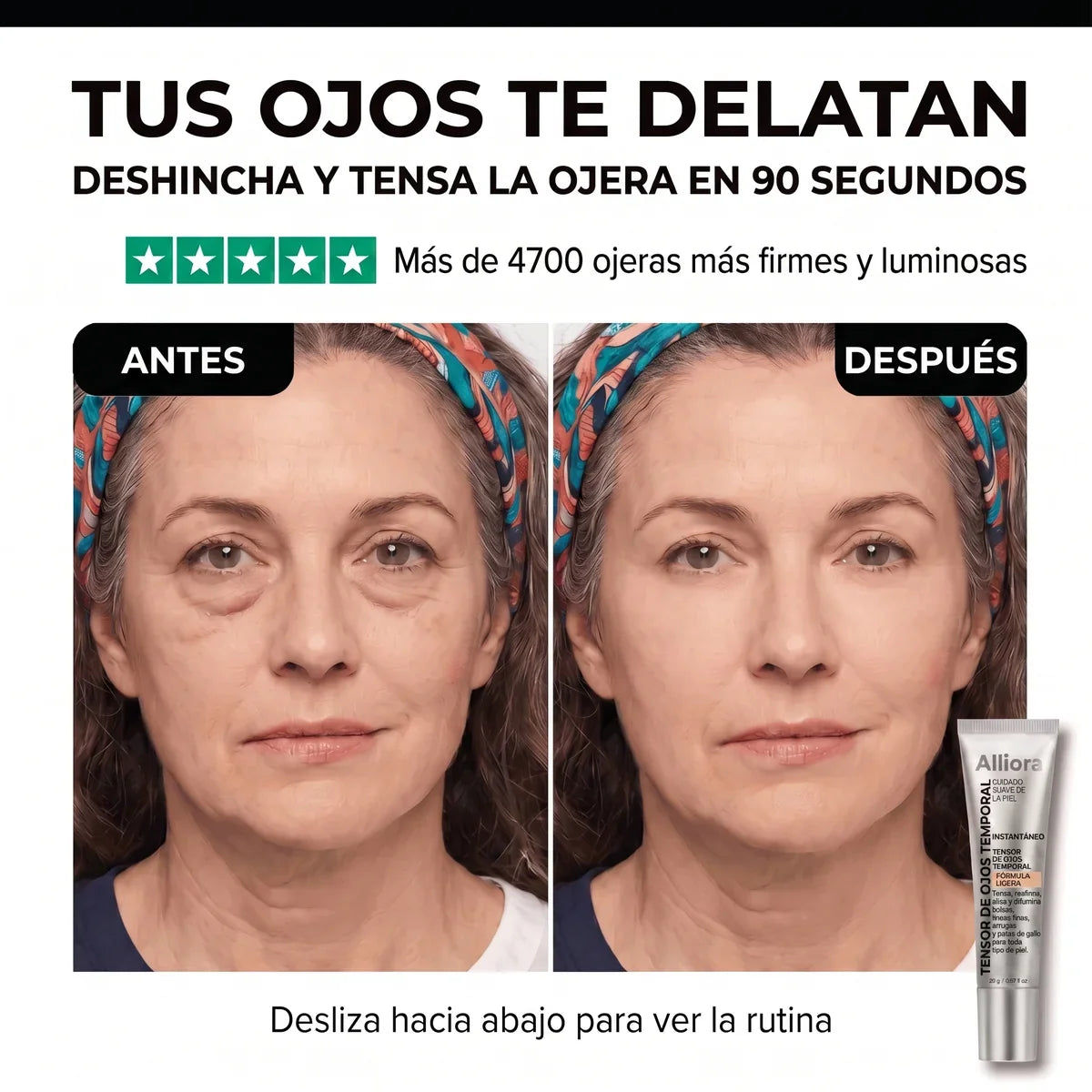 Tensor de Ojos Temporal