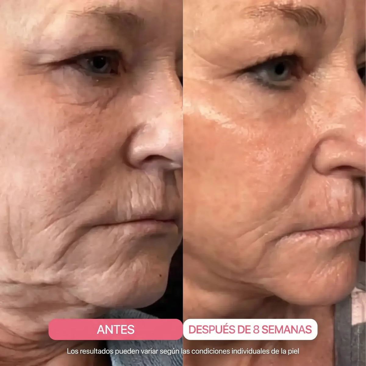 Mascarilla de Colágeno Ultraabsorbible Alliora
