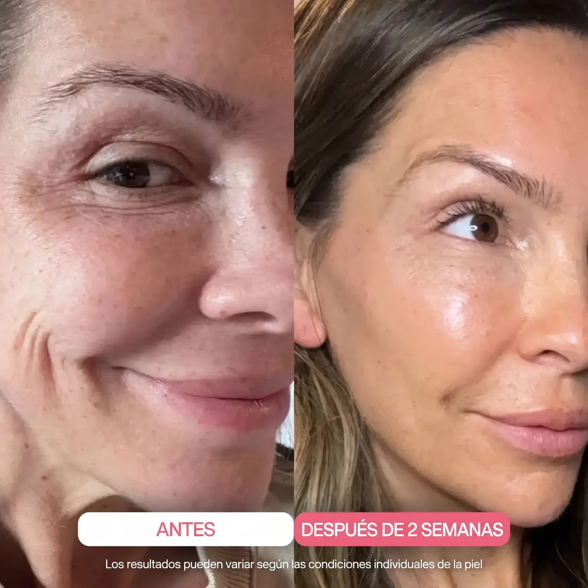 Mascarilla de Colágeno Ultraabsorbible Alliora