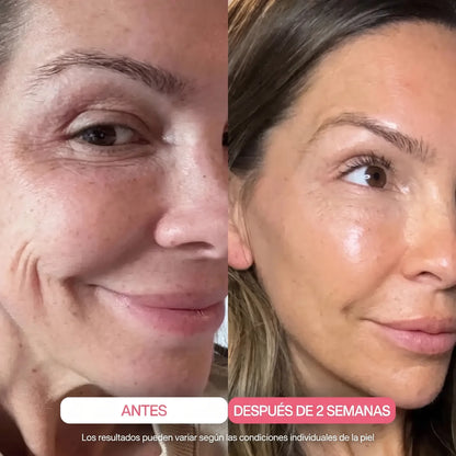 Mascarilla de Colágeno Ultraabsorbible Alliora