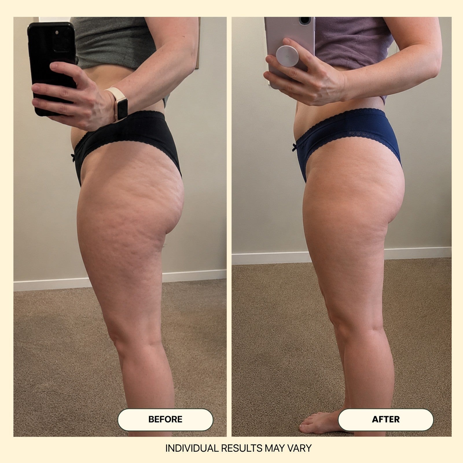 Alliora Anti-Cellulite Massage Oil