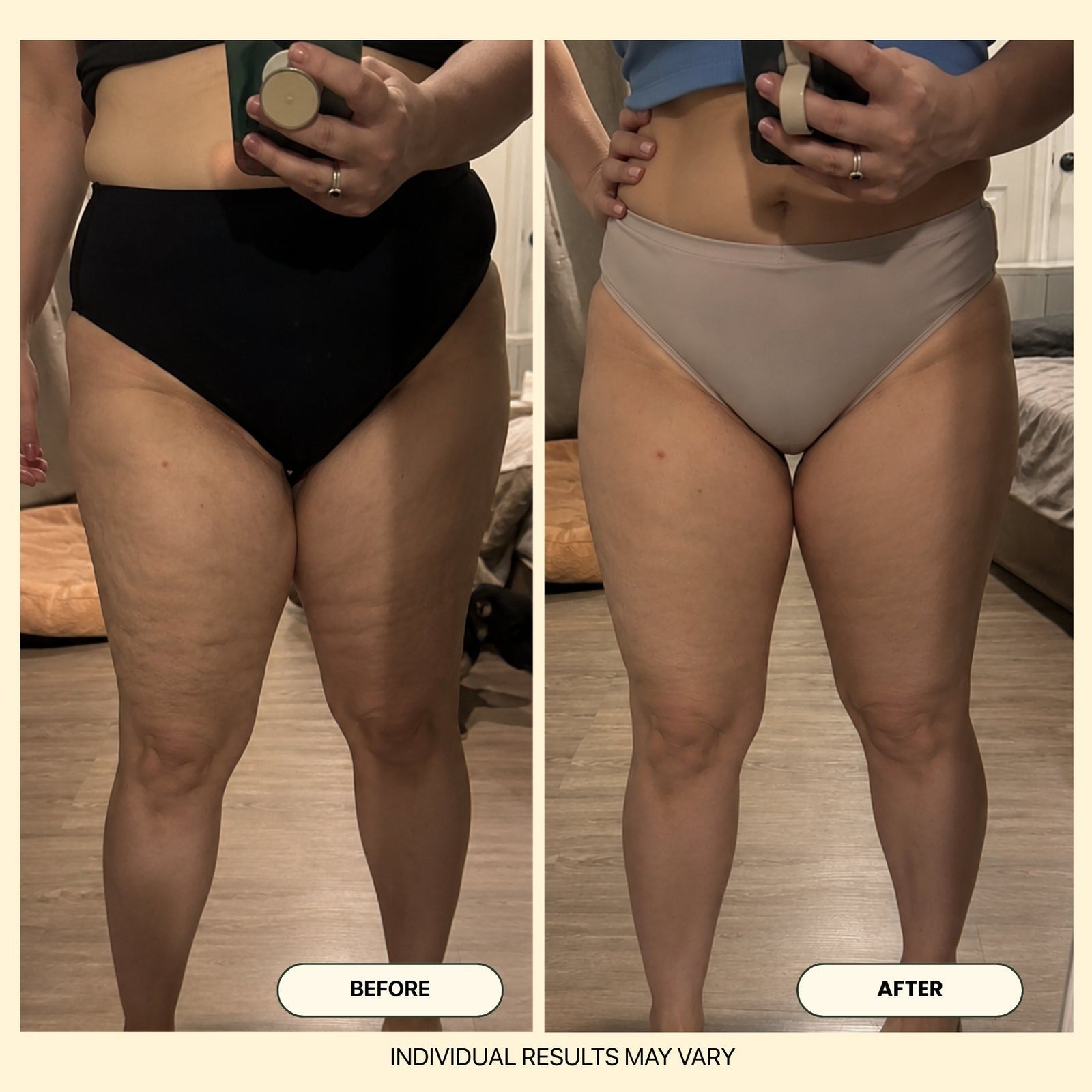Alliora Anti-Cellulite Massage Oil