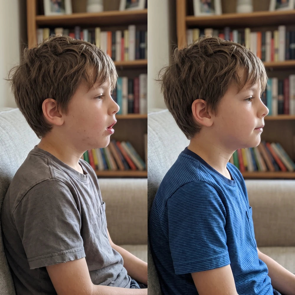 Avant après de profil : bouche ouverte puis bouche fermée